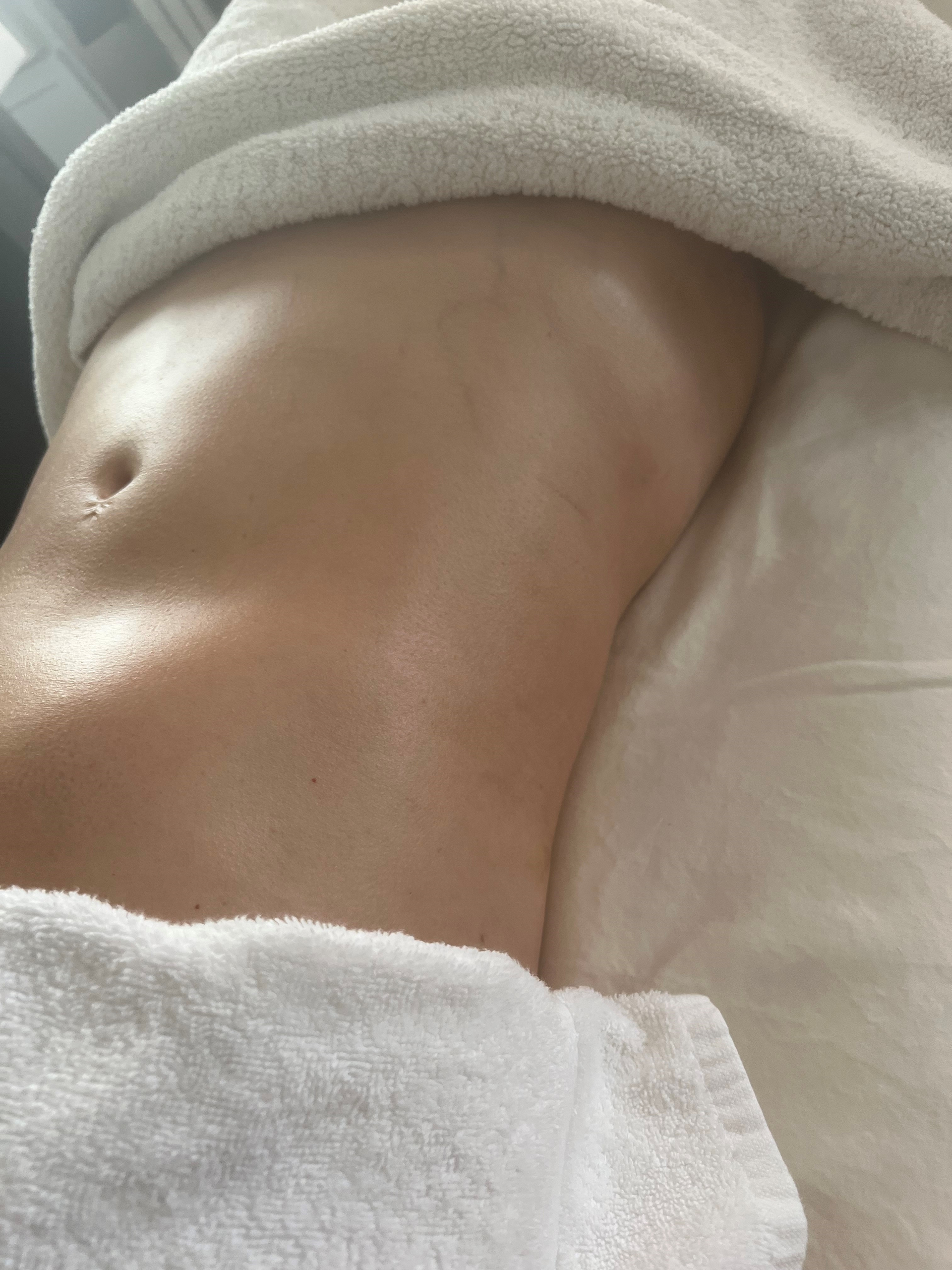 Before lymphatic drainage procedure