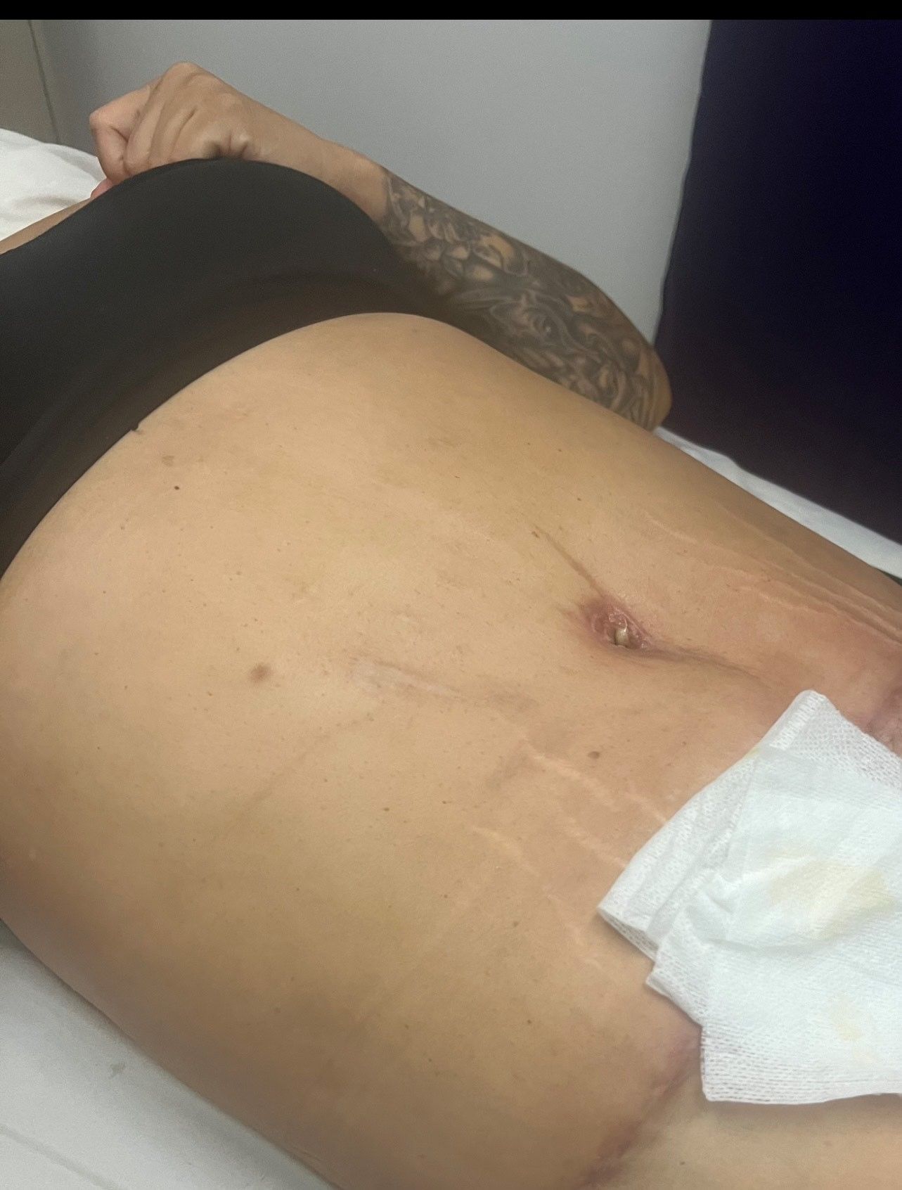 A woman is laying on a bed with a towel on her stomach.