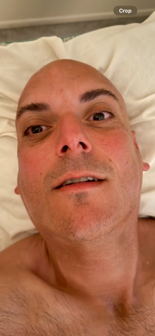 A bald man is laying on a bed and looking at the camera.