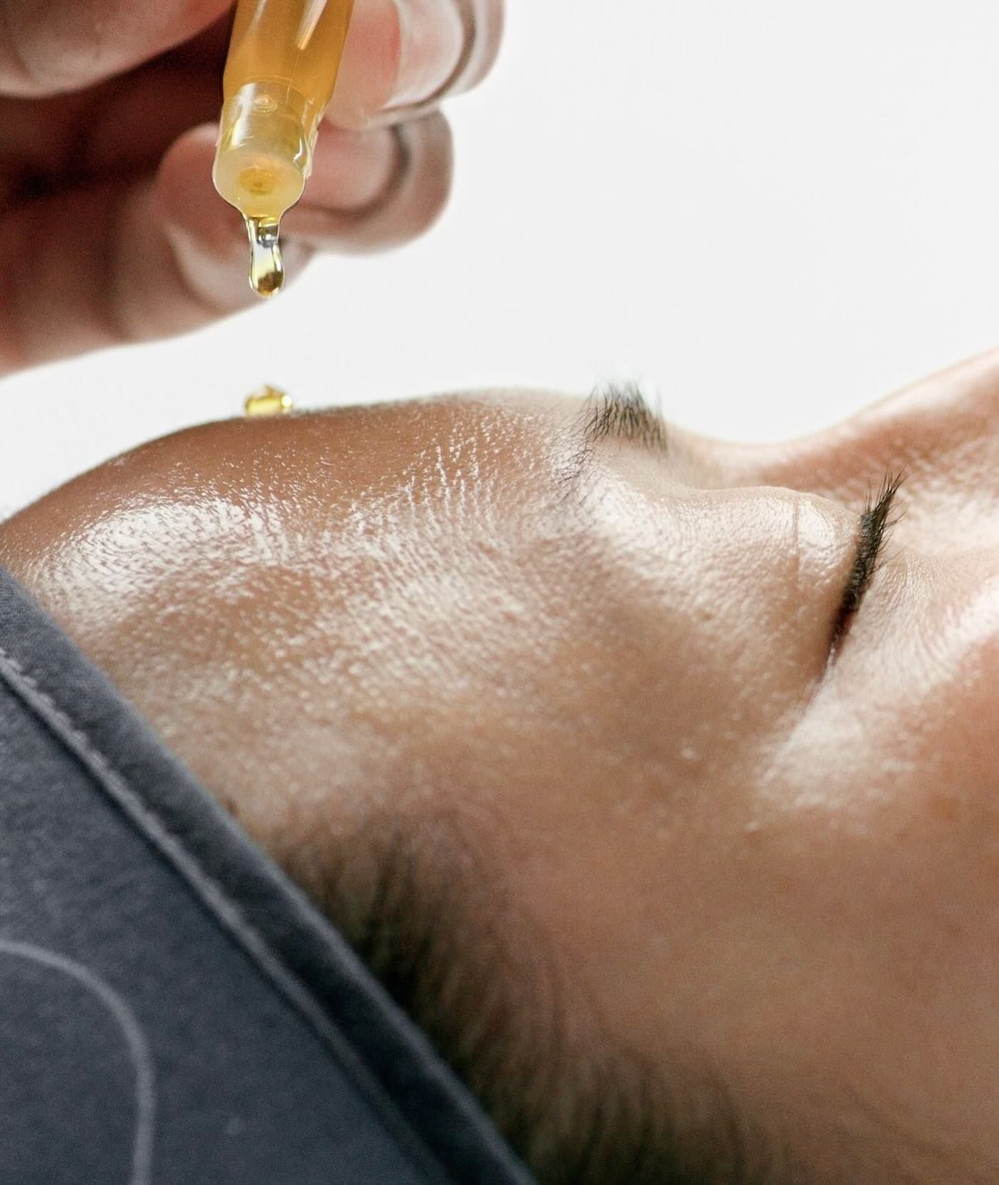 Person's face with oil being applied to forehead from a dropper. Skin is shiny, close-up shot.
