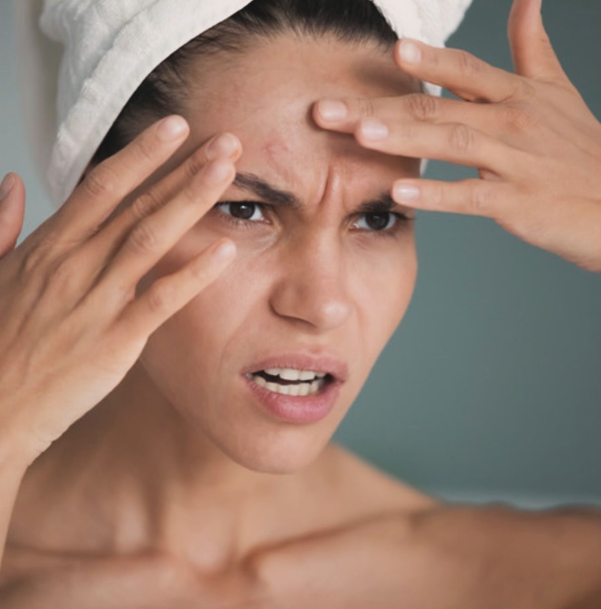 Woman with a towel on her head examines her forehead in a mirror, looking concerned about blemishes.