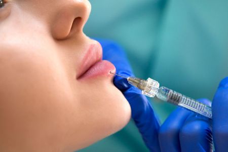 A woman is getting an injection in her lips.