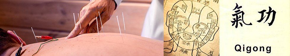 Acupuncture service