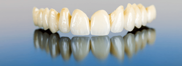 Dental crowns