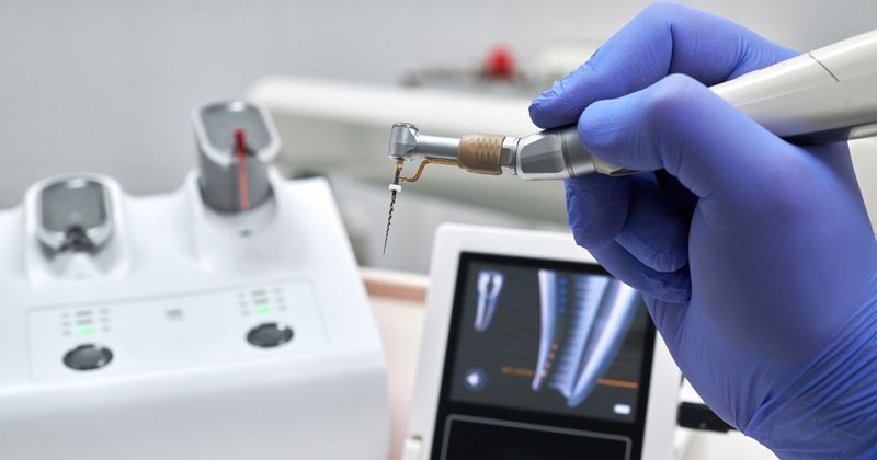 A gloved hand holds a dental endodontic motor with a file, next to a diagnostic monitor in a clinical setting.