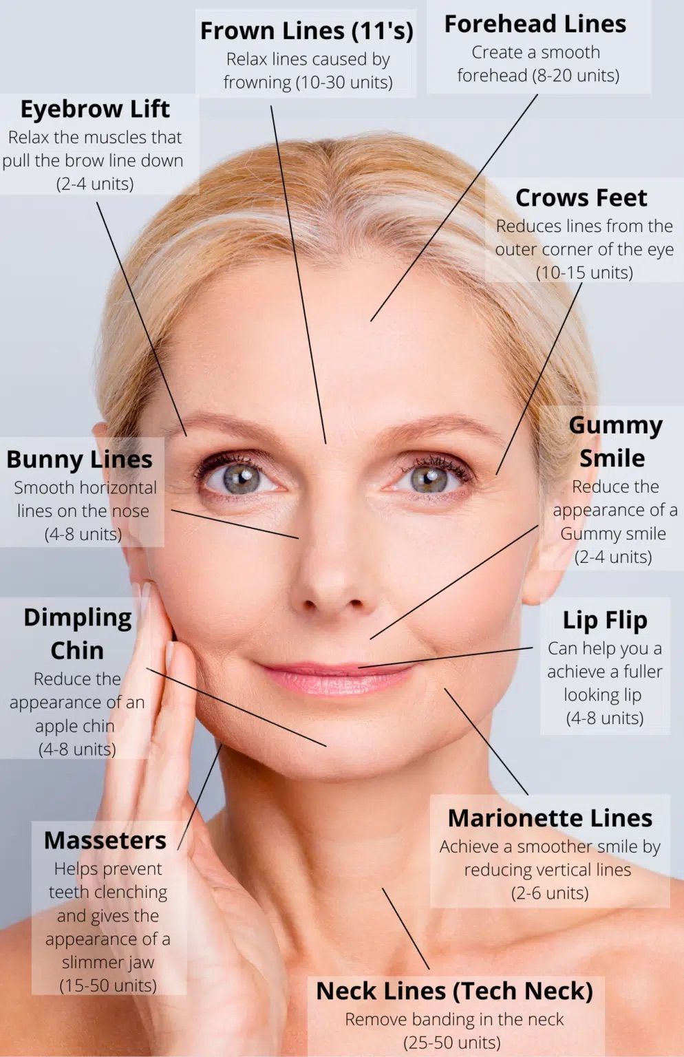 A woman 's face is shown with arrows pointing to different parts of her face.