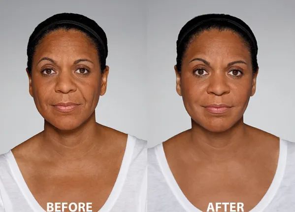 A before and after photo of a woman's face