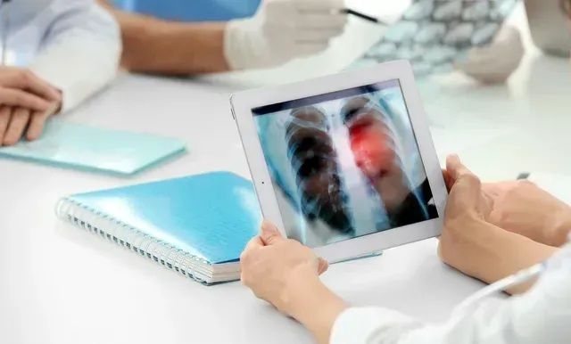 Doctors examining a chest X-ray on a tablet, highlighting a red area possibly indicating a medical issue.