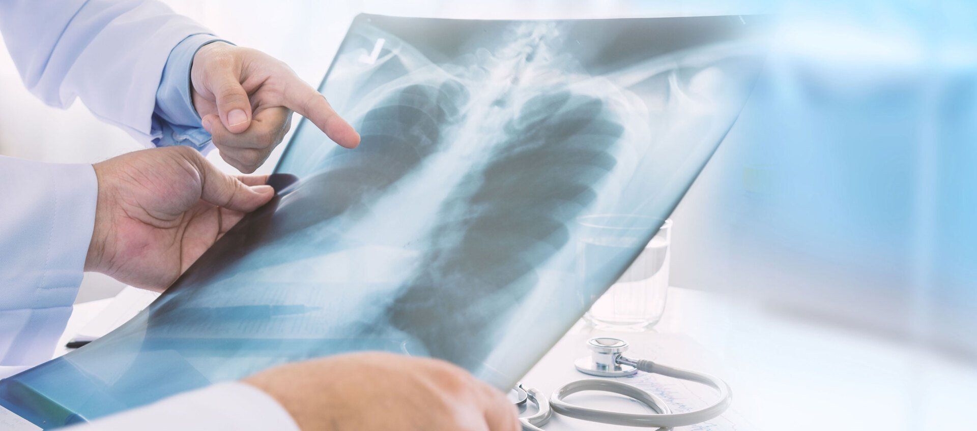 Two doctors examining a chest X-ray, pointing out something of interest. A stethoscope is nearby.