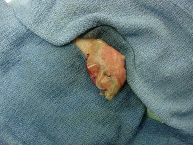 A piece of meat is sitting on top of a blue cloth.