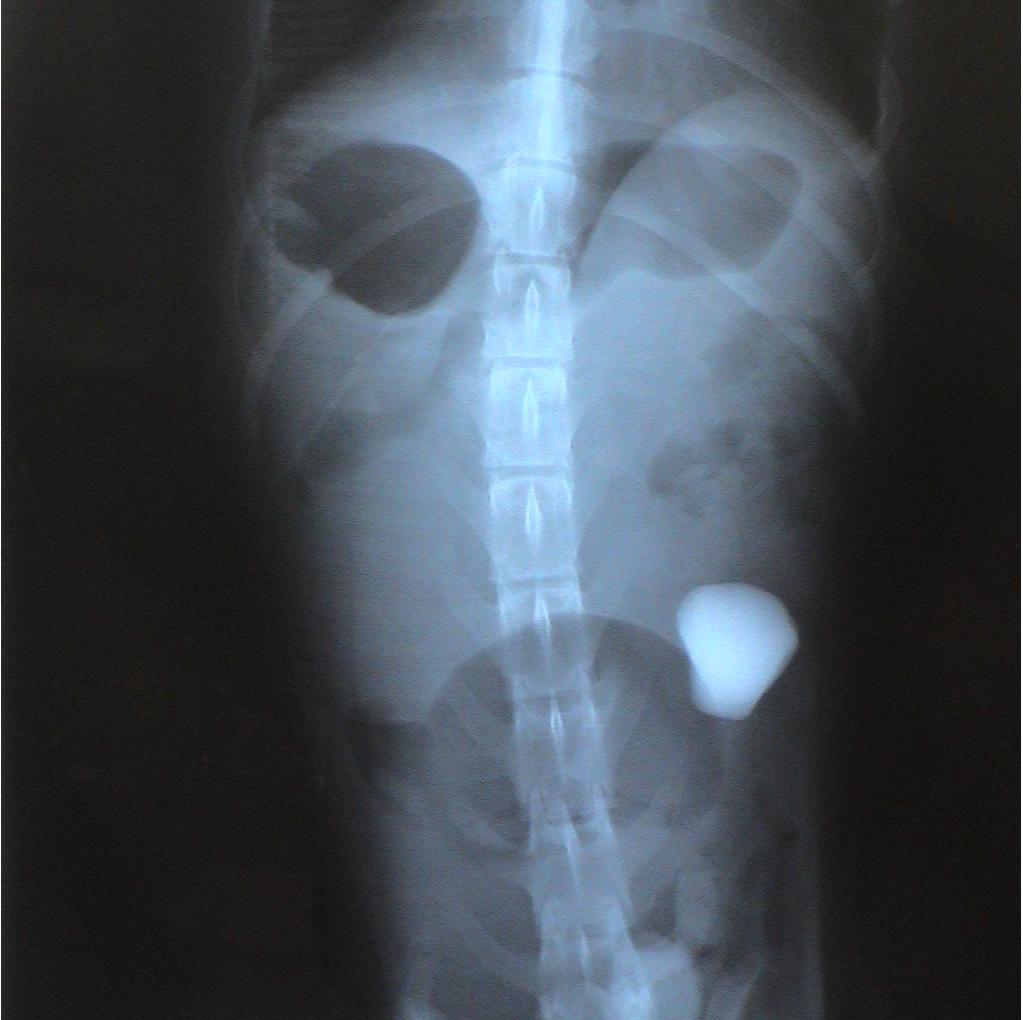 A black and white x-ray of a person 's stomach and spine.