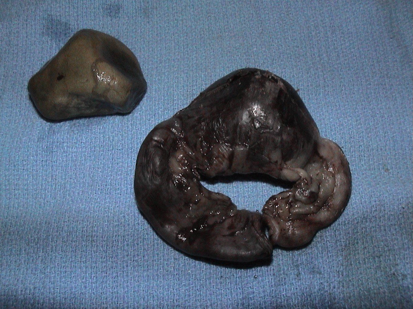 A large rock and a smaller rock are on a blue cloth.