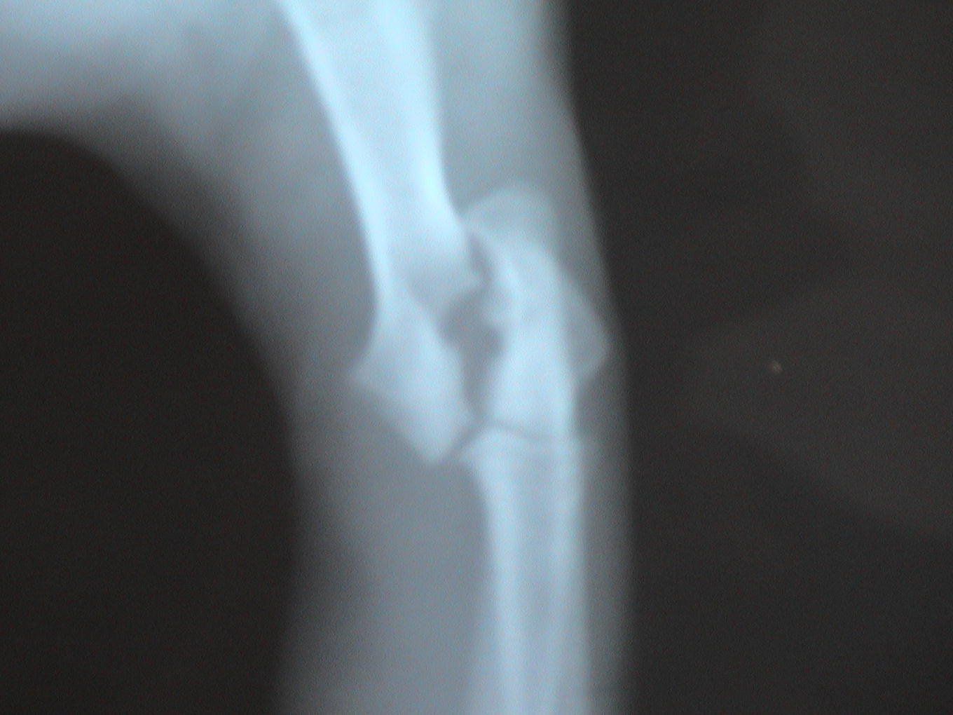 An x-ray of a dog 's elbow with a broken bone.