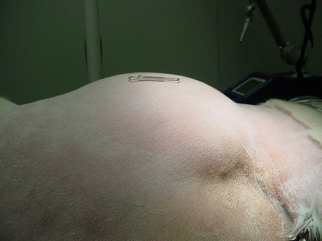 A close up of a person 's shoulder with a needle sticking out of it.