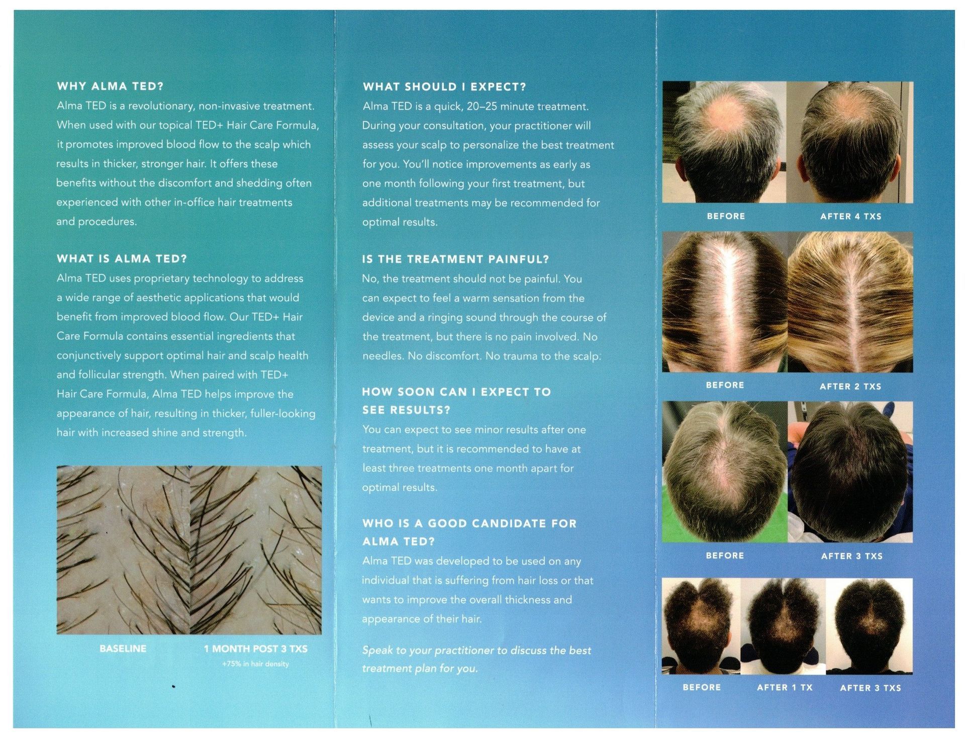 alma ted for hair loss page 2