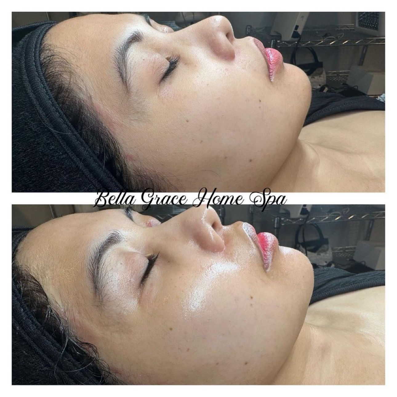 Woman's face with eyes closed before/after facial treatment. Skin looks cleaner, smoother. In spa setting.