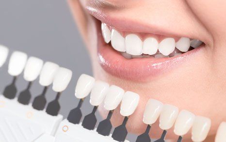 White teeth dental implants