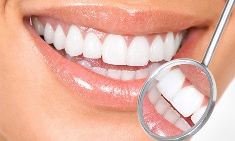 White teeth of woman