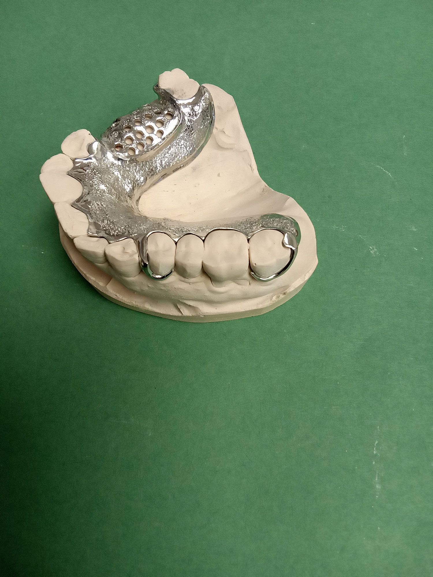 A model of a tooth with a metal brace on it is sitting on a green surface.