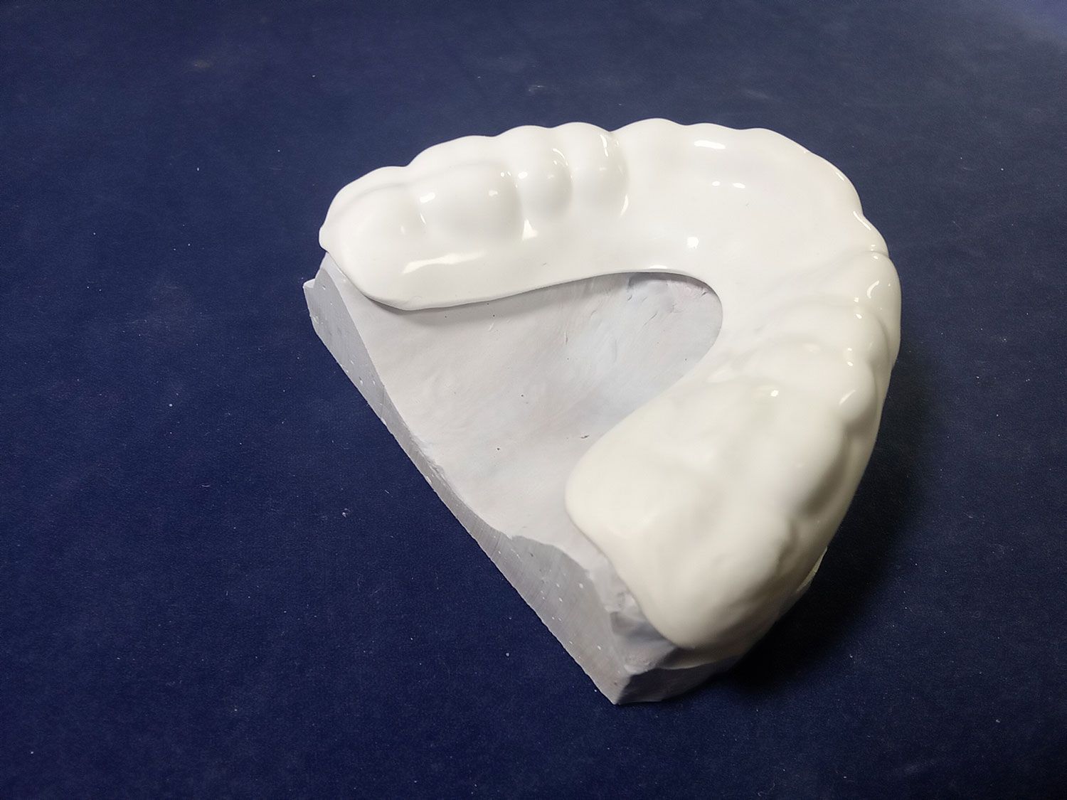 A white tooth model is sitting on a blue surface