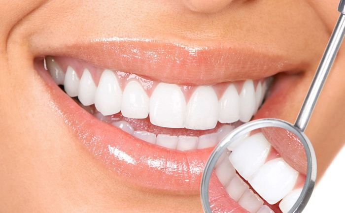 A woman is smiling while having her teeth examined by a dentist.