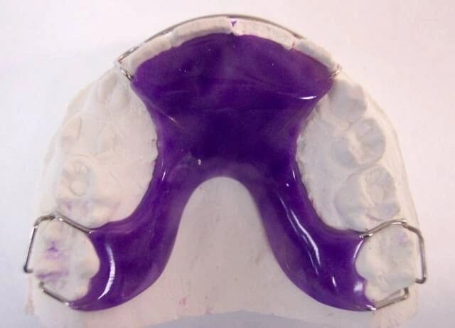 A purple dental retainer is sitting on a white surface