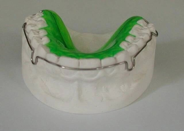 A model of a mouth with green teeth and braces