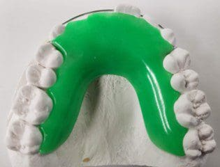 A model of a person 's teeth with a green brace on it.