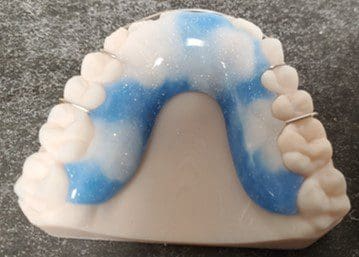 A model of a person 's teeth with braces on them.