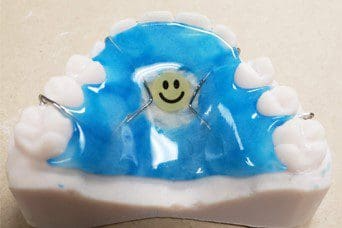 A model of a child 's teeth with a smiley face on it.