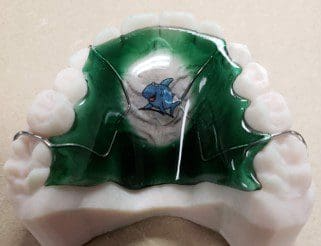 A close up of a dental retainer with a dolphin on it.