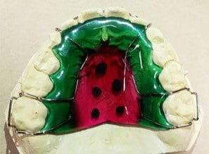 It looks like a watermelon with holes in it.