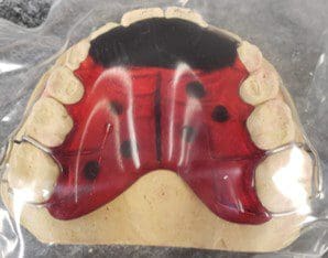 A close up of a dental model with a red brace on it.