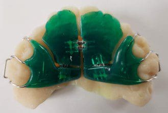 A pair of green dental braces on a white surface.