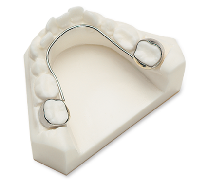 A model of a tooth with a metal brace on it