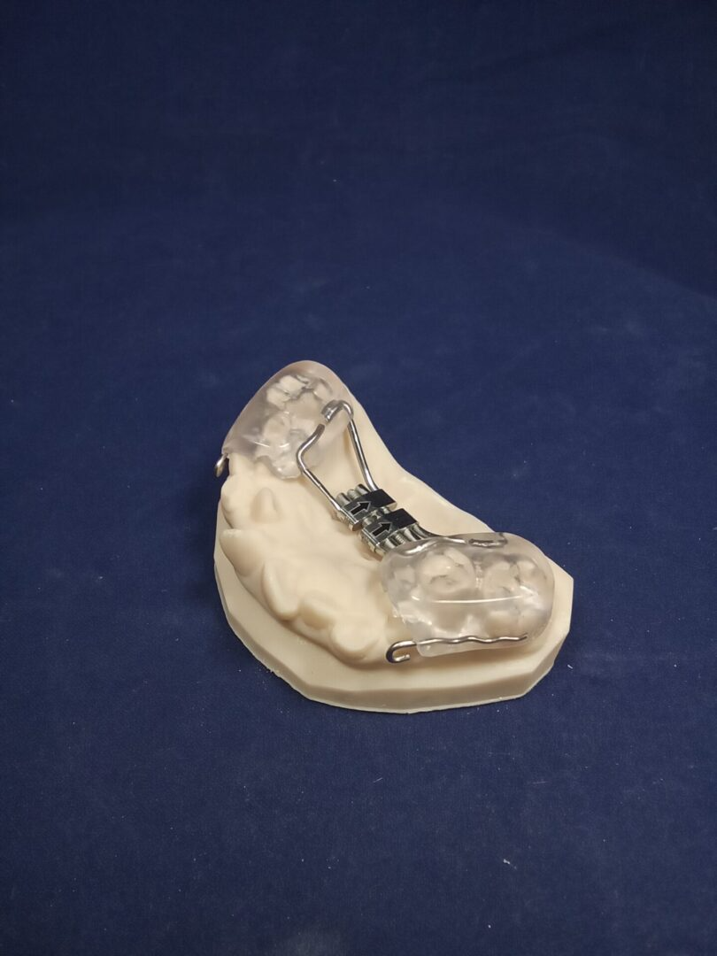 A model of a tooth with a chain attached to it