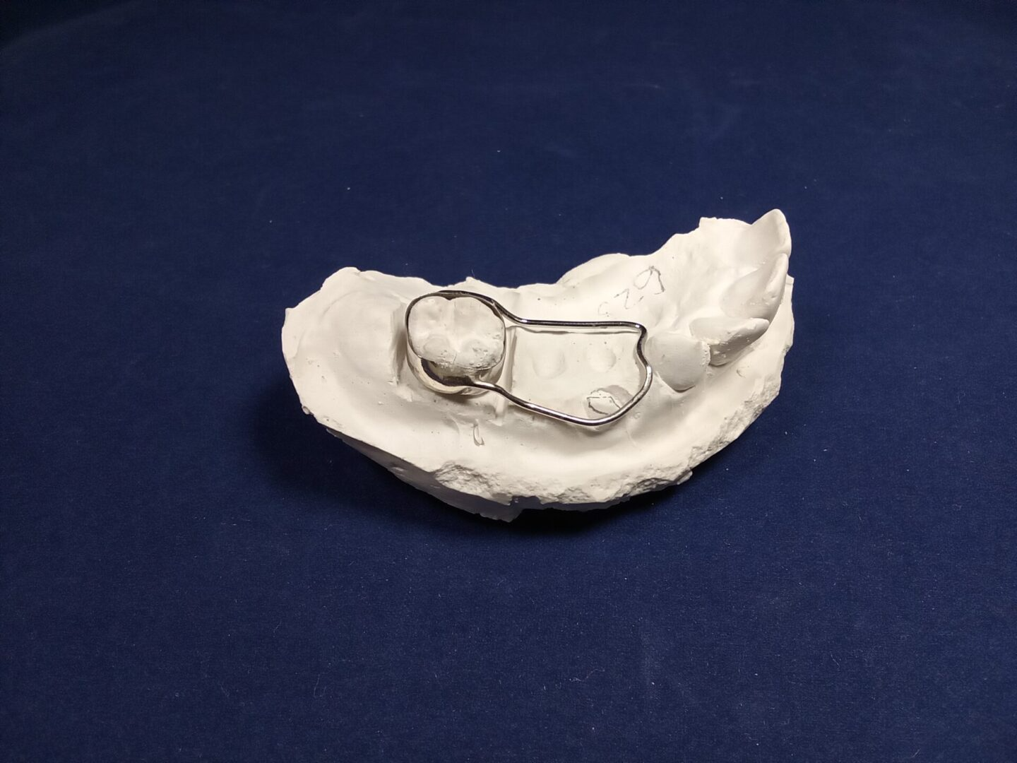 A model of a tooth is sitting on a blue surface