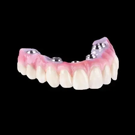 A close up of a denture on a black background.