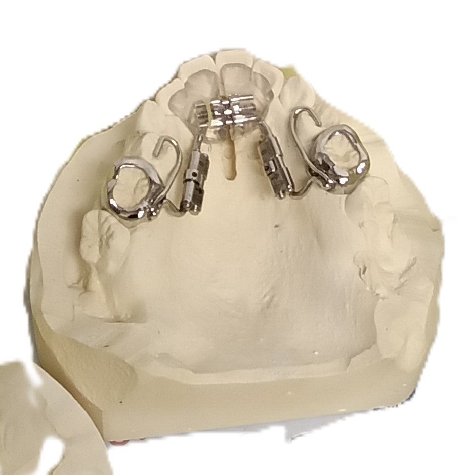 A model of a person's teeth with braces on it