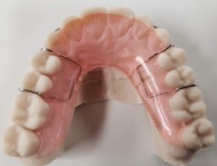 A close up of a dental brace on a white surface.