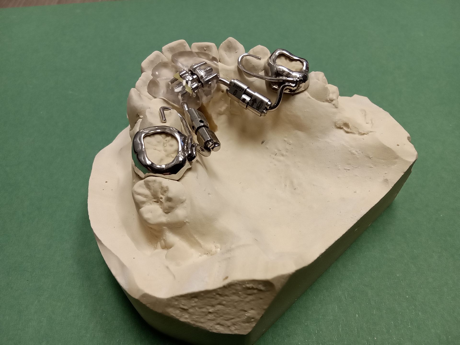 A model of a person's teeth is sitting on a green surface