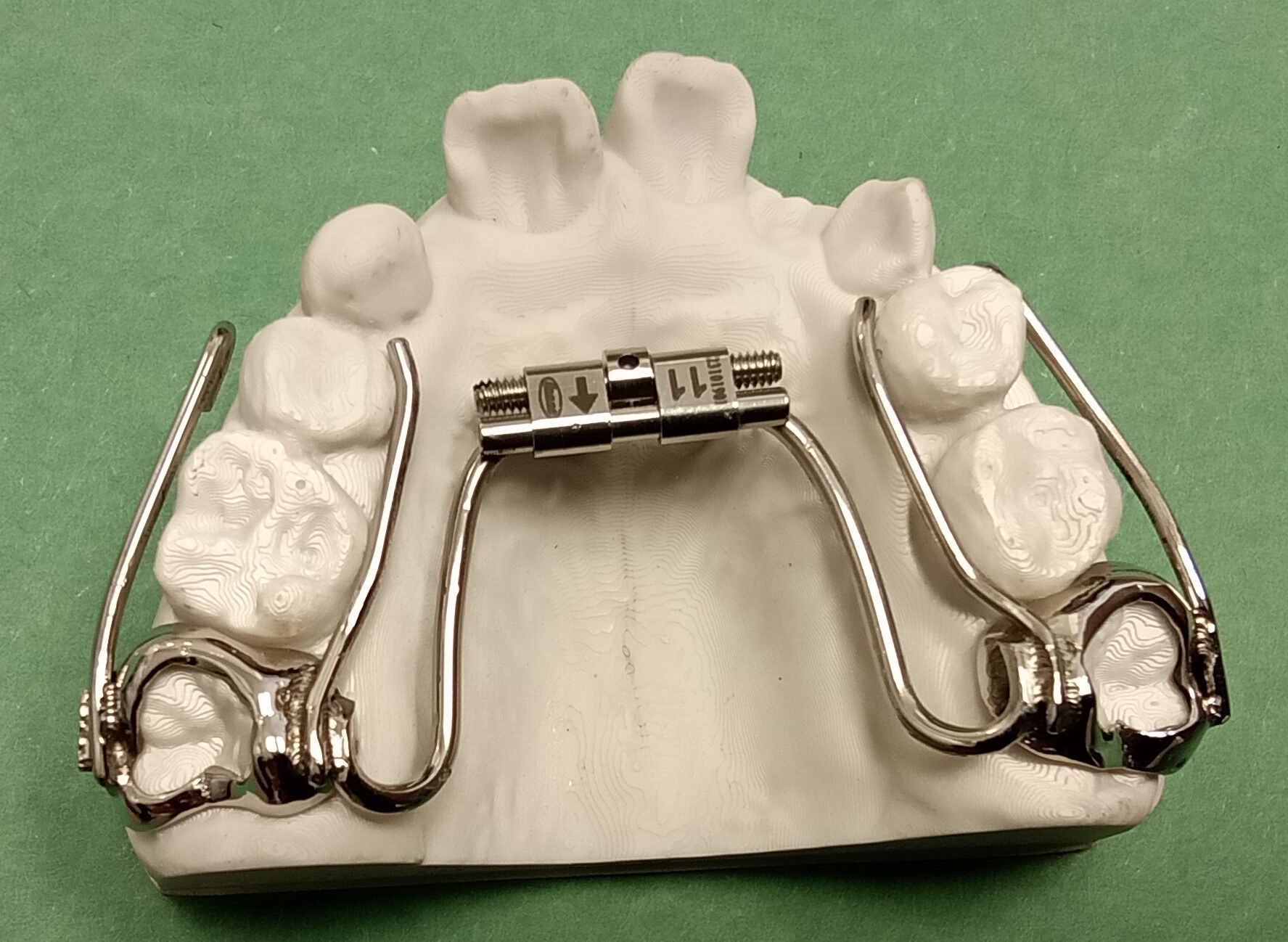 An orthodontic compact expander