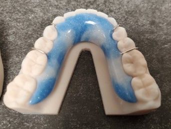 A close up of a model of a tooth with braces on it.