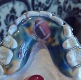 A close up of a person's teeth with a football on it.