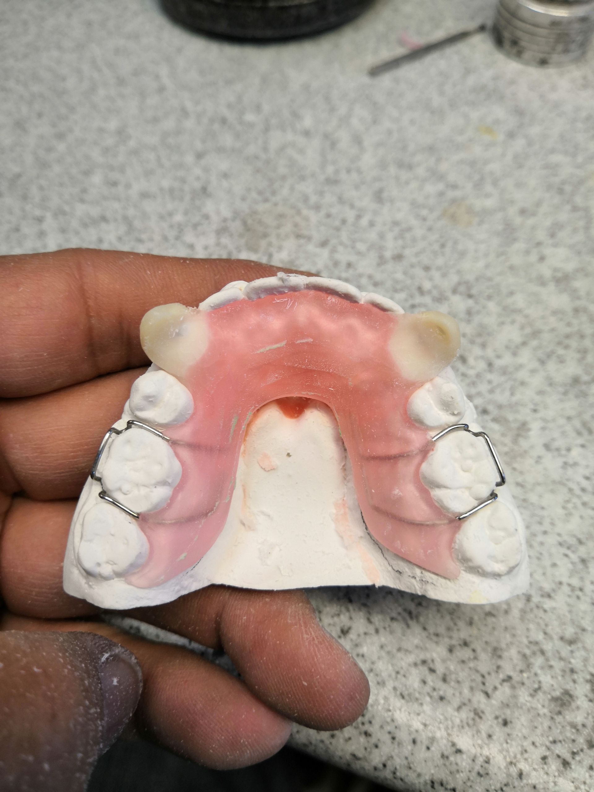 A person is holding a denture in their hand.