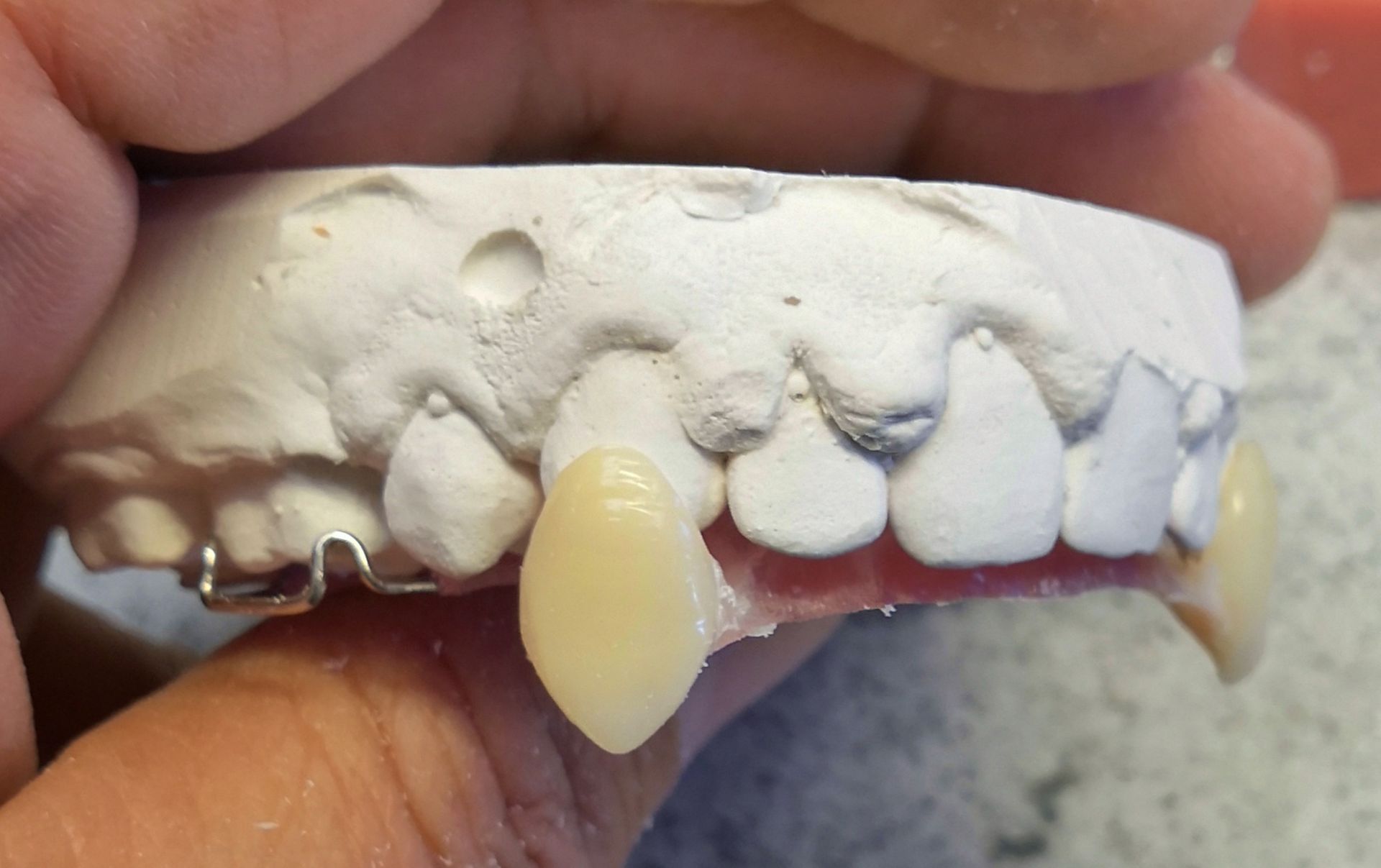 A person is holding a model of a person 's teeth in their hand.