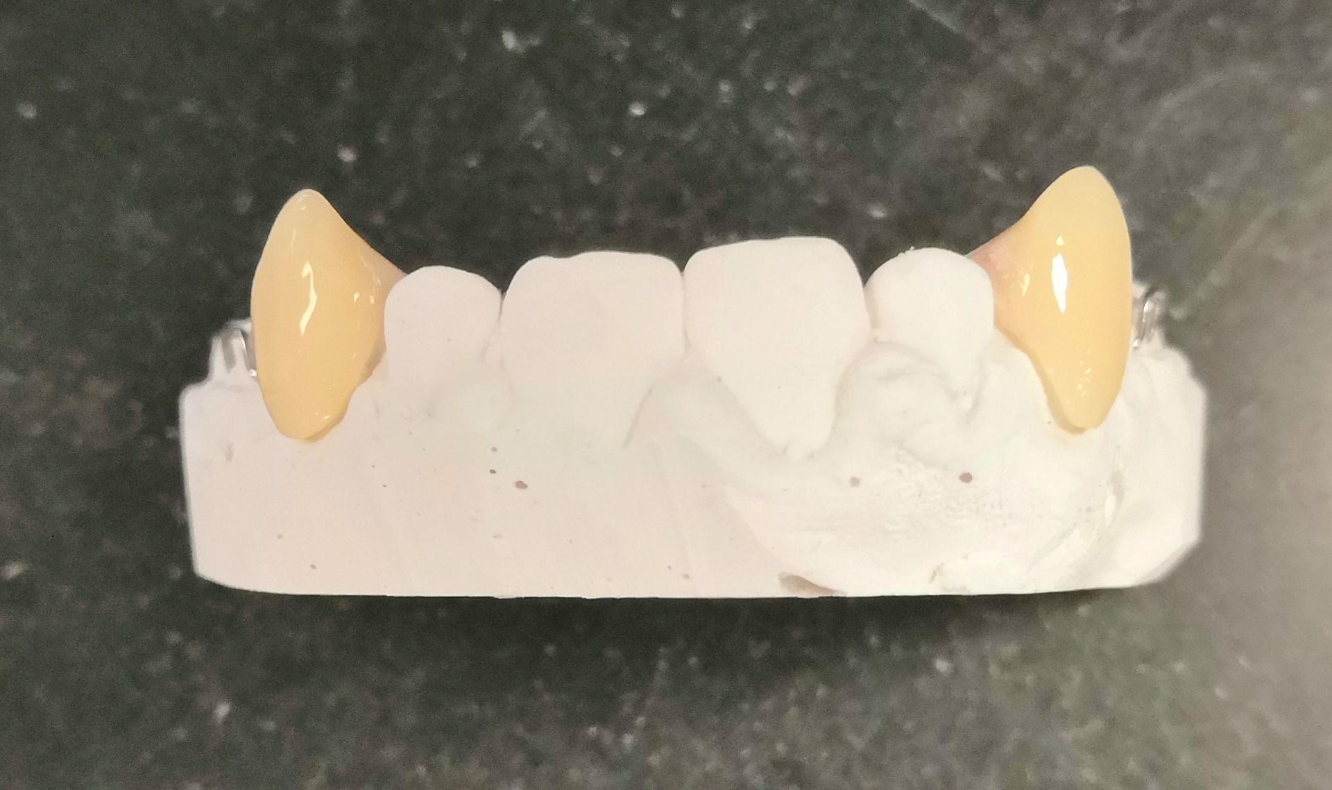 A close up of a model of a person's teeth on a table.