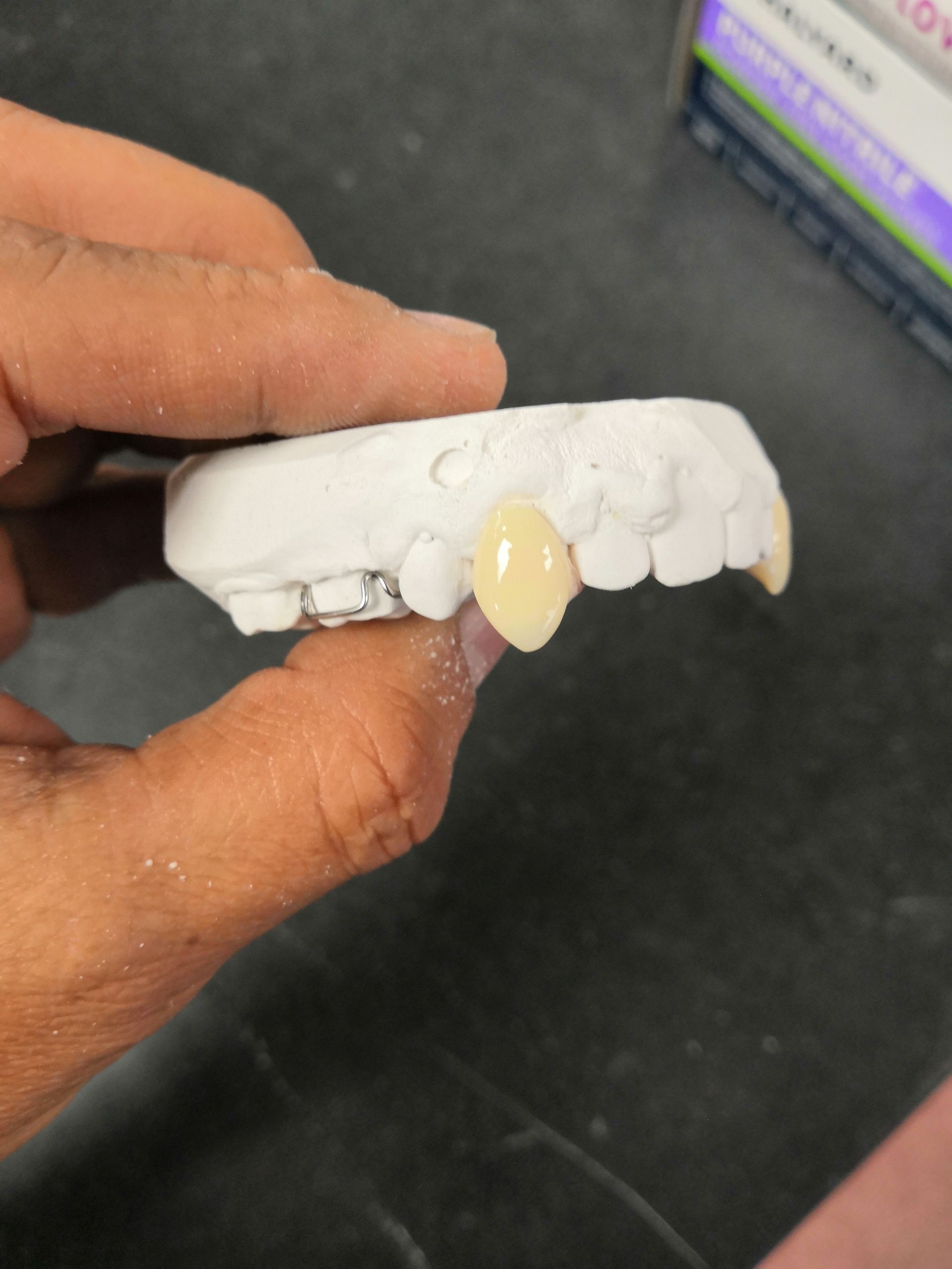 A person is holding a tooth model in their hand