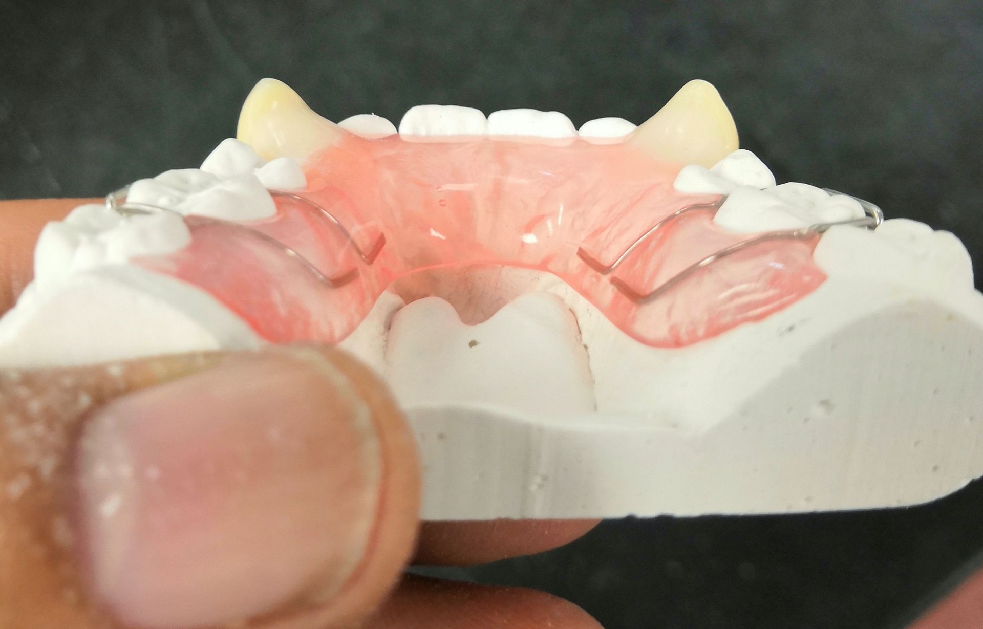 A person is holding a model of a person's teeth