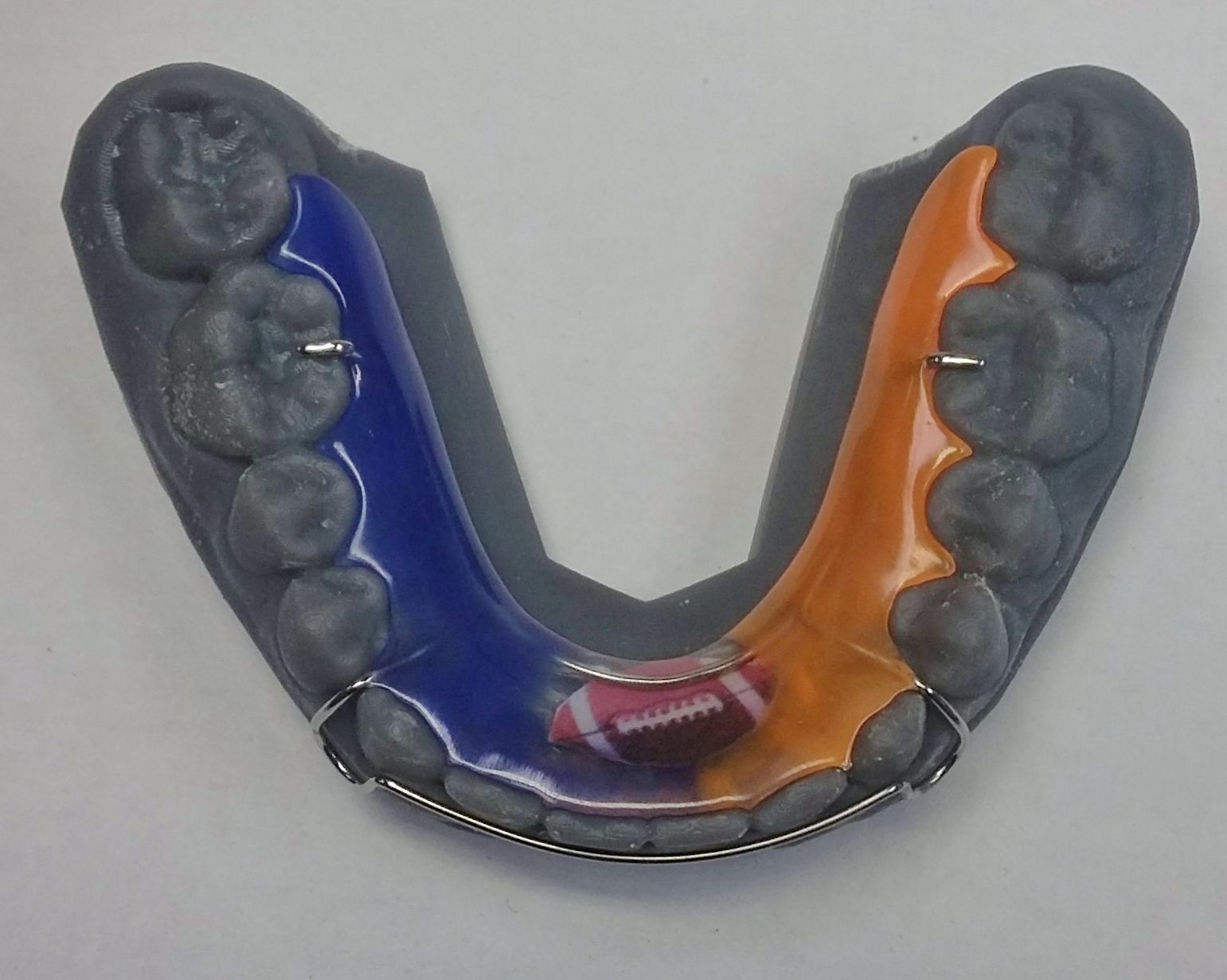 A model of teeth with a football in the middle